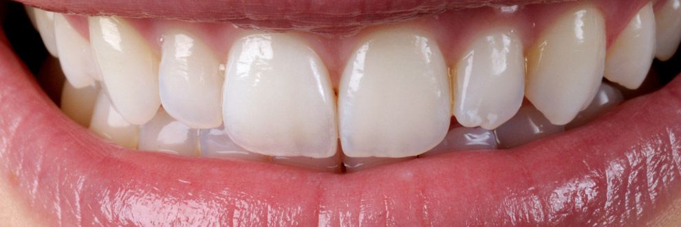 #nonprep03 Andreas Nolte - Dentallabor Münster