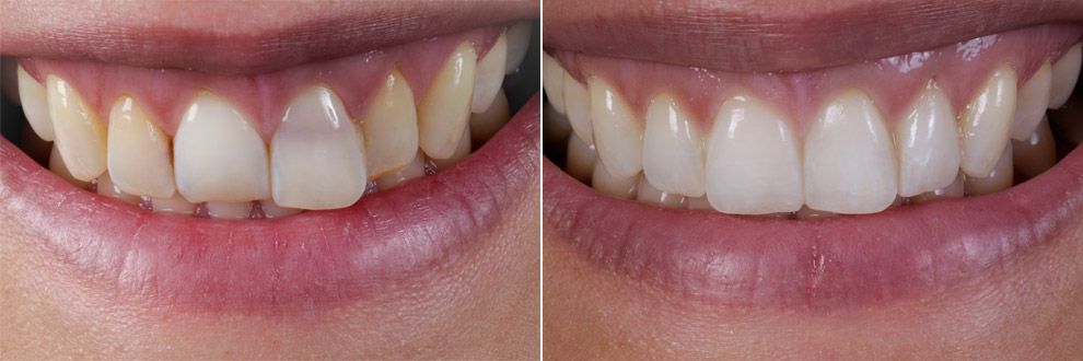 #nonprep05b Andreas Nolte - Dentallabor Münster