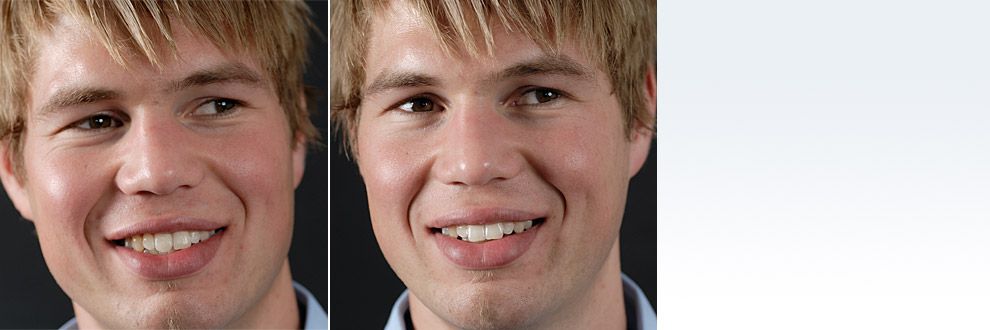 #nonprep09 Andreas Nolte - Dentallabor Münster