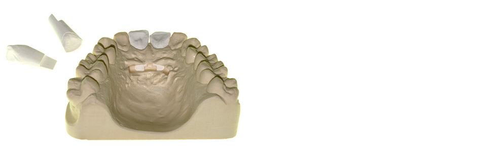 #produkte05 Andreas Nolte - Dentallabor Münster